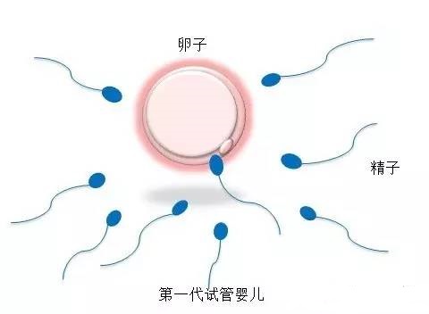 生殖妇科